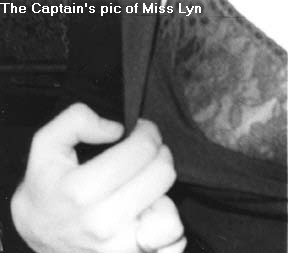 Miss Lyn's boob by Cpt.Sensible and Rat Scabies